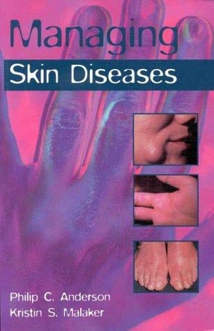 Managing skin diseases