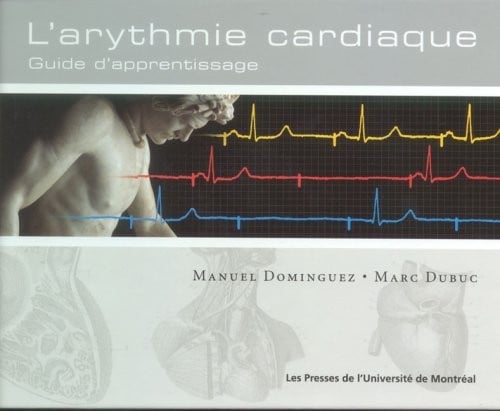 Arythmie cardiaque