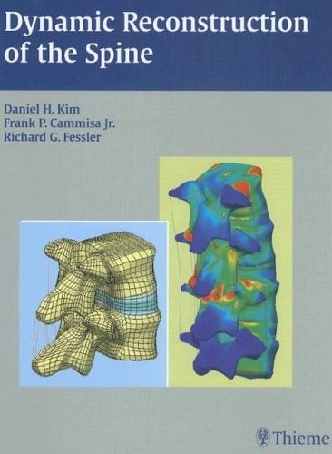 Dynamic reconstruction of the spine