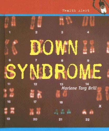 Down Syndrome (Health Aleart)