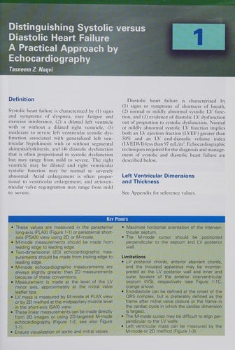 Echocardiography in heart failure