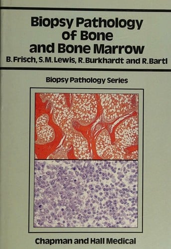 Biopsy pathology of bone and bone marrow