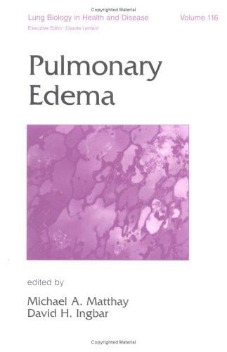 Pulmonary edema