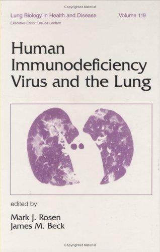 Human immunodeficiency virus and the lung