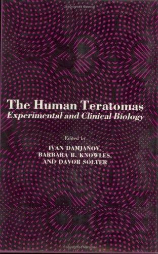 The Human teratomas