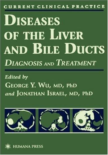 Diseases of the liver and bile ducts