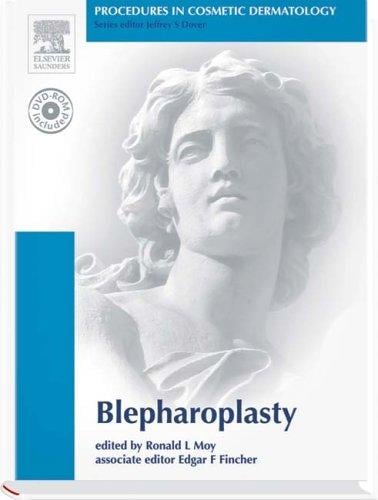 Procedures in Cosmetic Dermatology Series: Blepharoplasty