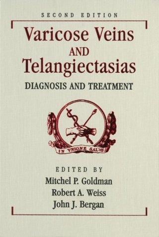 Varicose veins and telangiectasias