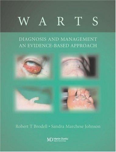 Warts