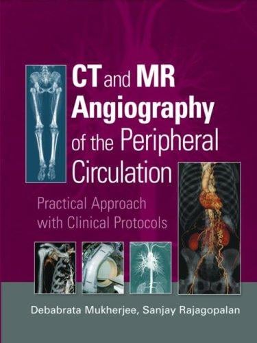 CT and MR angiography of the peripheral circulation
