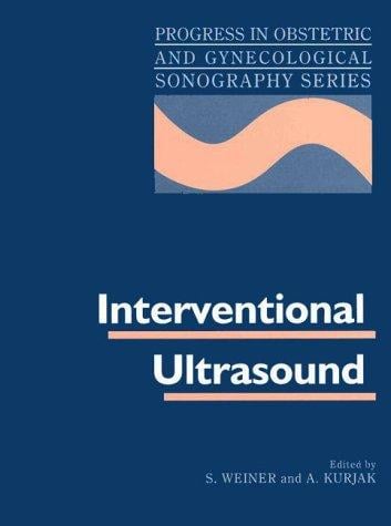 Interventional ultrasound
