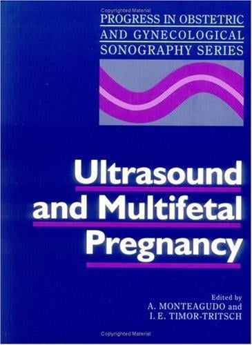 Ultrasound and multifetal pregnancy