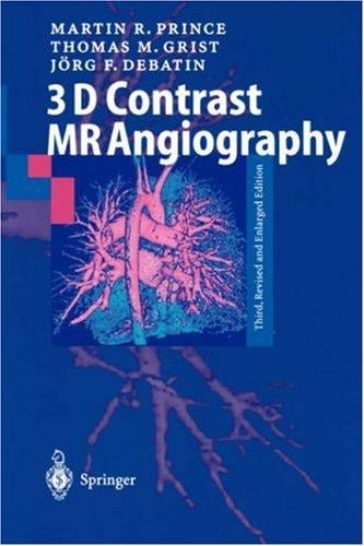 3D contrast MR angiography