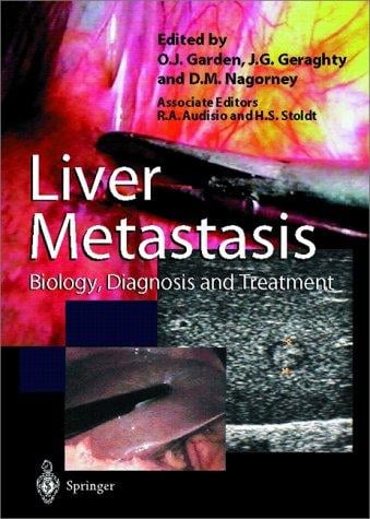 Liver metastases