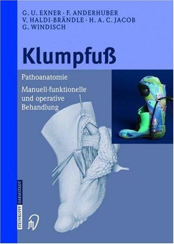 Klumpfu©