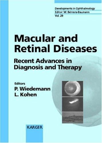 Macular and retinal diseases