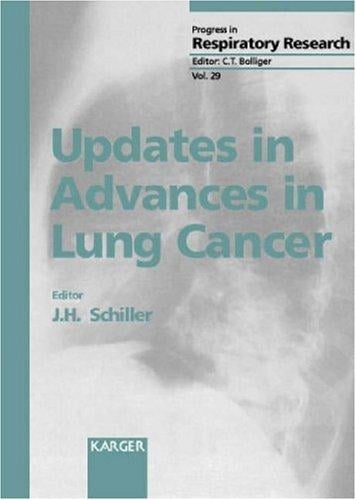 Updates in advances in lung cancer