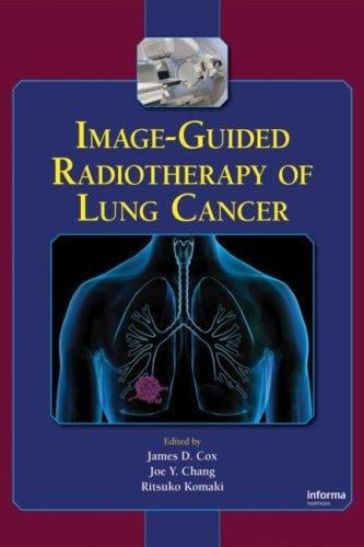 Image-guided radiotherapy of lung cancer