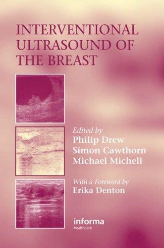 Interventional ultrasound of the breast