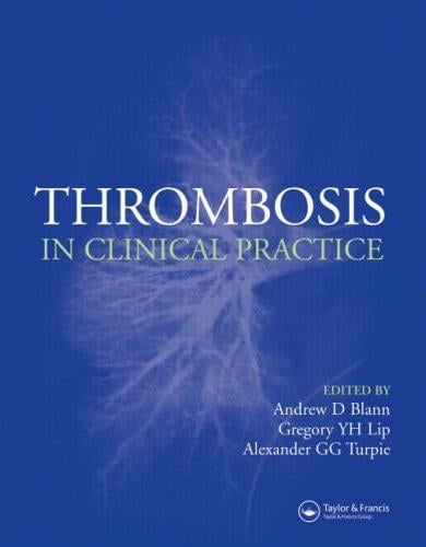 Thrombosis in clinical practice