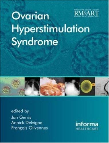 OVARIAN HYPERSTIMULATION SYNDROME; ED. BY JAN GERRIS