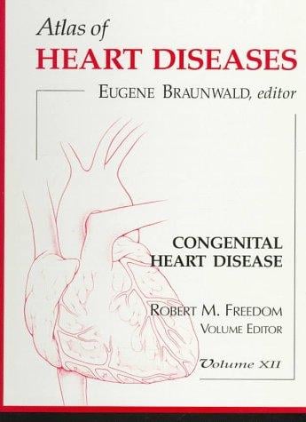 Congenital heart disease