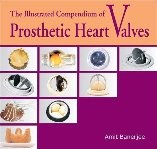 The Illustrated Compendium of Prosthetic Heart Valves