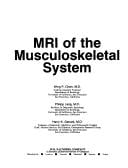MRI of the musculoskeletal system