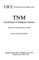TNM classification of malignant tumours
