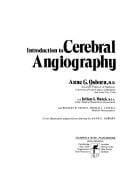 Introduction to cerebral angiography