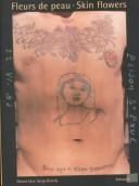 Fleurs de peau =