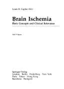 Brain Ischemia