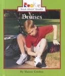 Bruises