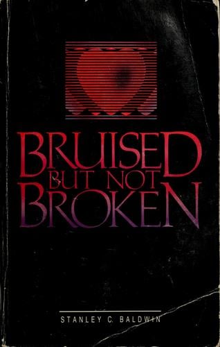 Bruised but not broken