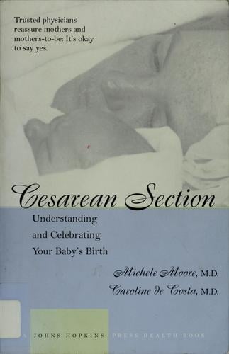 Cesarean section