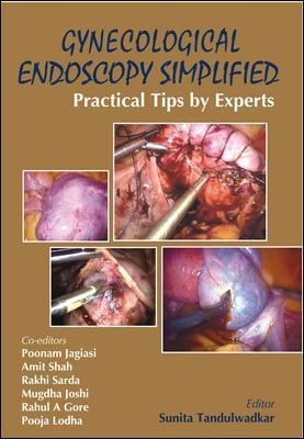 Gynecological Endoscopy Simplified Practical Tips By Experts