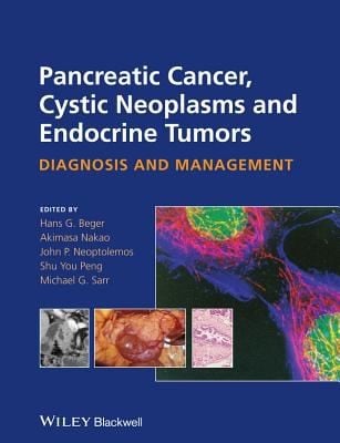 Pancreatic Cancer Cystic and Endocrine Neoplasm