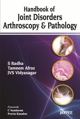 Synovium The Arthroscopy And Pathology