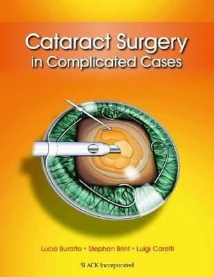 Cataract Surgery In Complicated Cases