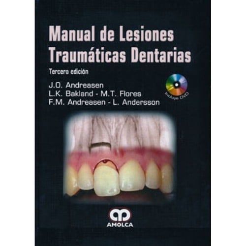 Manual de lesiones dentarias traumáticas - 3. ed.