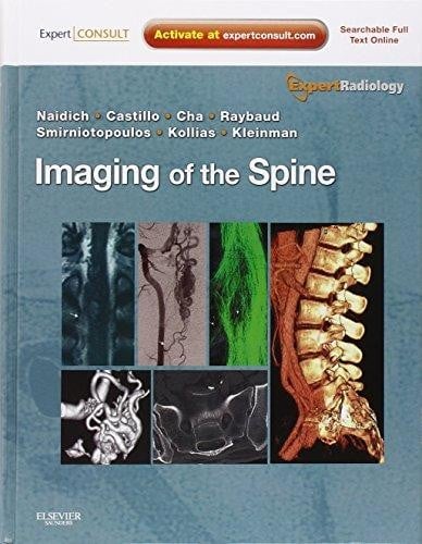 Imaging of the spine