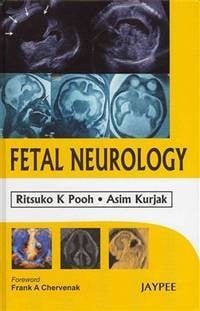 Neurología fetal