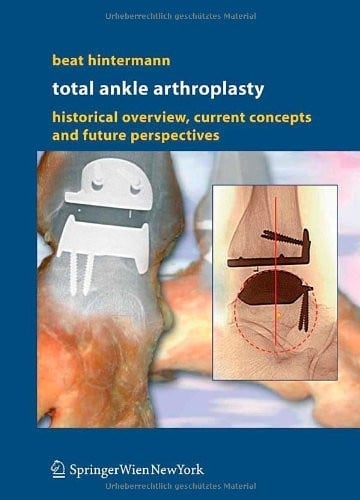 Total Ankle Arthroplasty: Historical Overview, Current Concepts and Future Perspectives