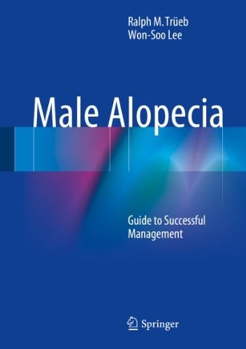 Male Alopecia: Guide to Successful Management