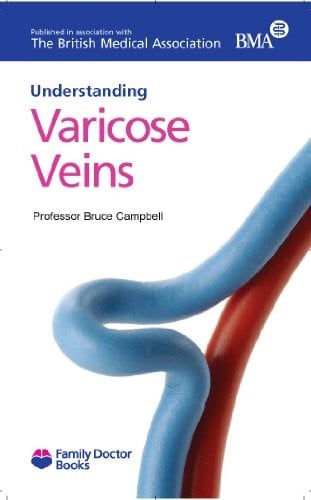 Understanding Varicose Veins (Family Doctor Publications)