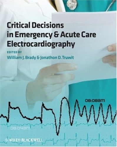 Critical decisions in emergency and acute care electrocardiography