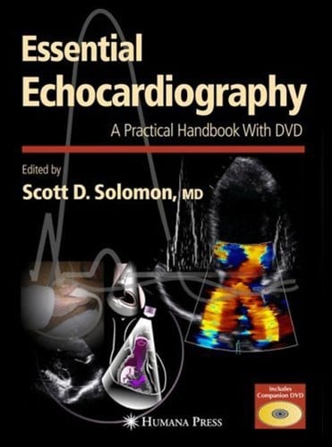 Essential echocardiography