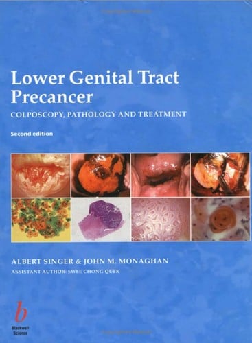 Lower genital tract precancer