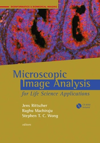 Microscopic image analysis for life science applications