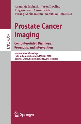 Prostate cancer imaging